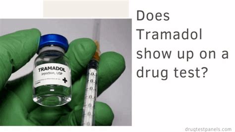 Does Tramadol Show on Drug Tests: Unraveling the Mysteries of Modern Pharmacology